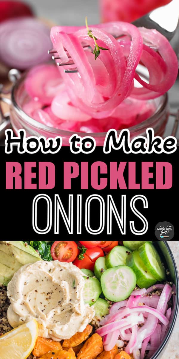 red pickled onions pin